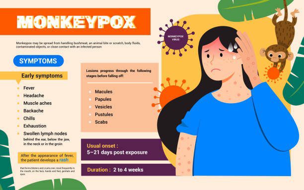 Monkeypox symptoms infographic poster vector design