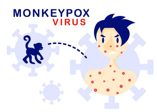 Monkeypox is a rare disease caused by infection with the monkeypox virus